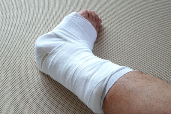 むち打ちの症状に効果的な施術
