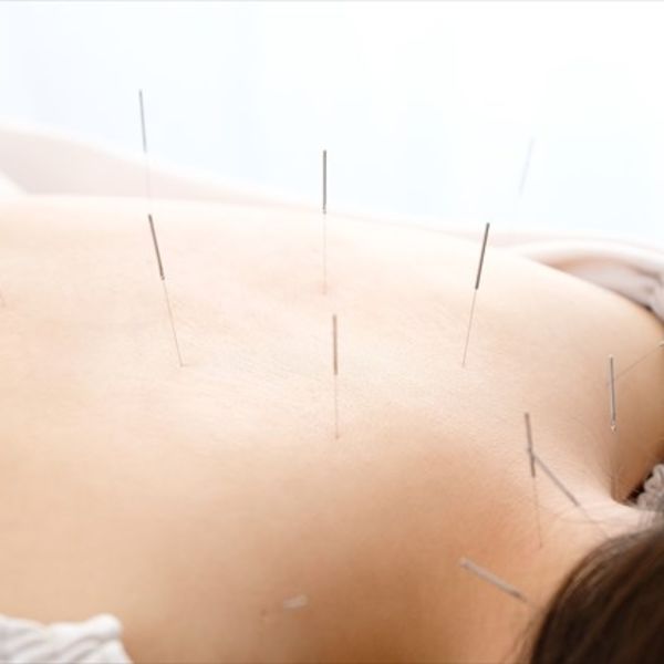 長門市にある長門ファミリーはりきゅう整骨院ではり施術をもっと身近におからだ整えましょう(*´▽｀*)